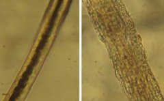猫咪常见病之猫癣